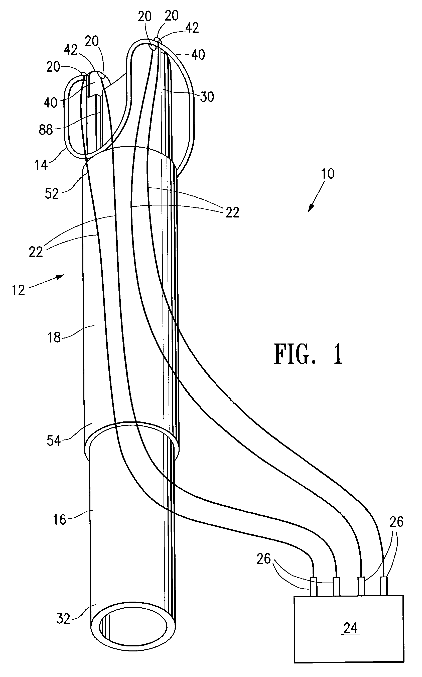 Deployable constrictor for uterine artery occlusion