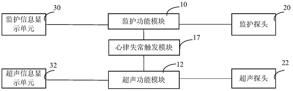 Arrhythmia detection device