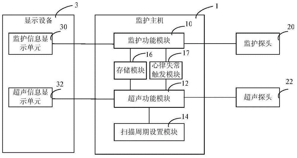 Arrhythmia detection device