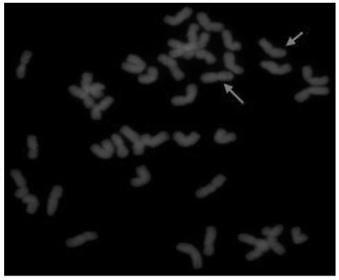 Breeding method for improving wheat scab resistance by using scab-resistant germplasm SF7EL9