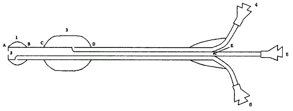 Balloon catheter for ultrasound-guided percutaneous pulmonary valve balloon dilatation