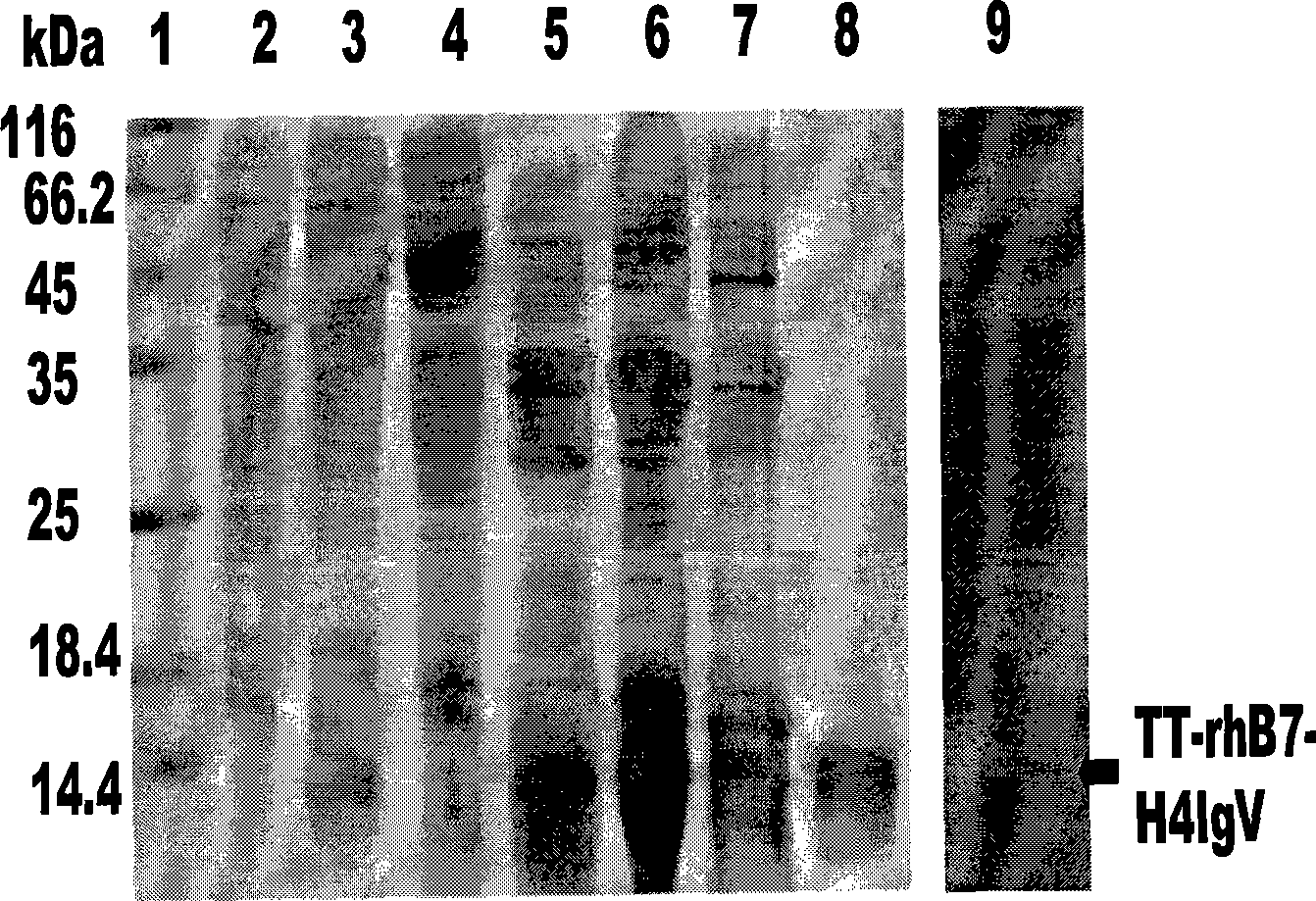 Fusion protein TT-B7-H4IgV as well as preparation method and application thereof