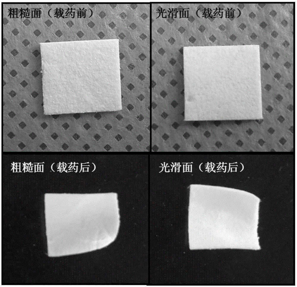 bFGF(basic fibroblast growth factor)-optimized ADM (acelluar dermal matrix) barrier membrane for promoting sclerous tissue regeneration as well as preparation method and application of ADM barrier membrane