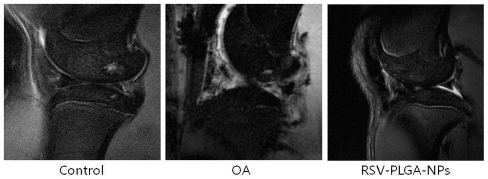 Application of resveratrol-polylactic acid long-acting nano-microspheres in preparation of anti-osteoarthritis drug