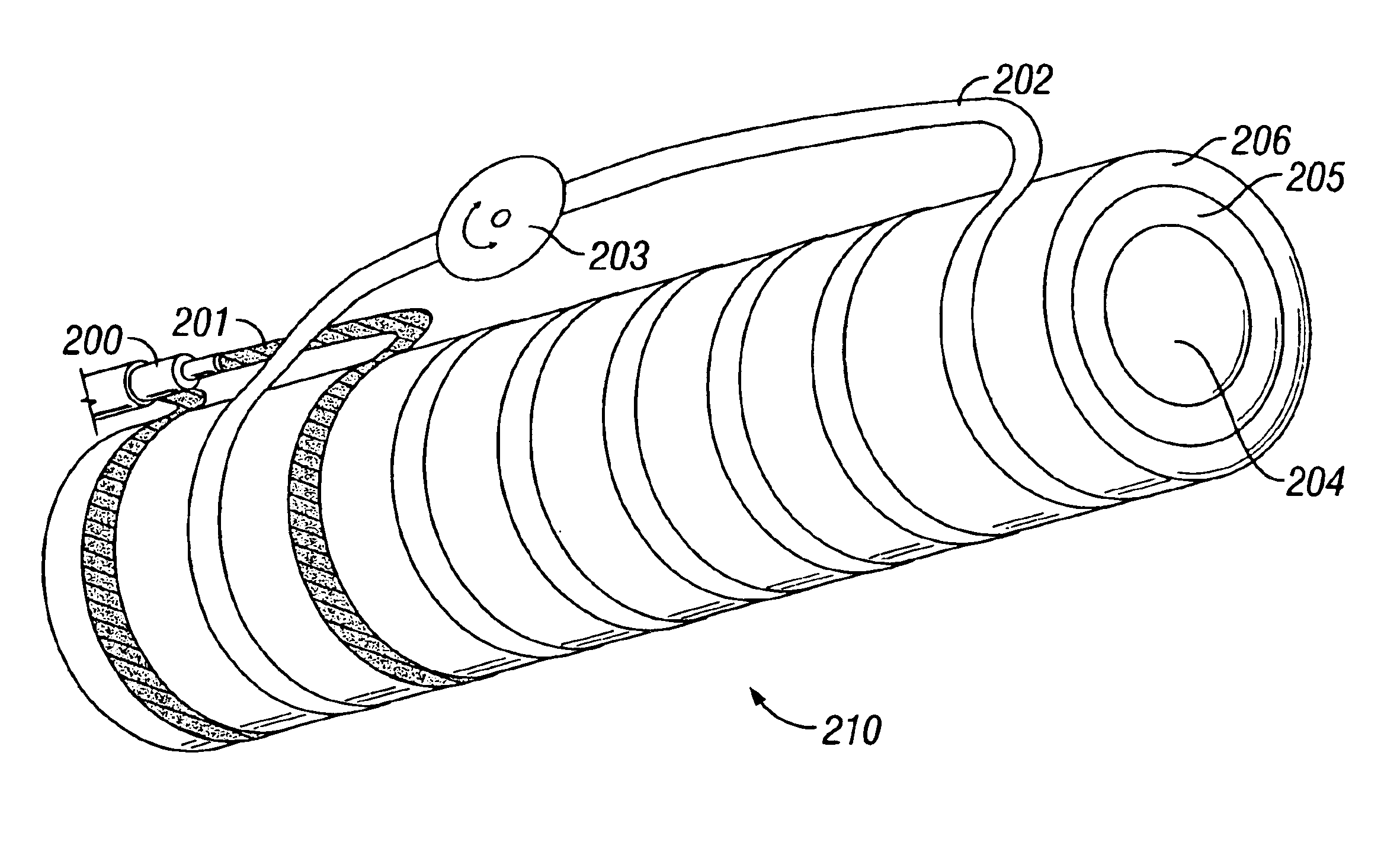 Apparatus for RF diathermy treatment