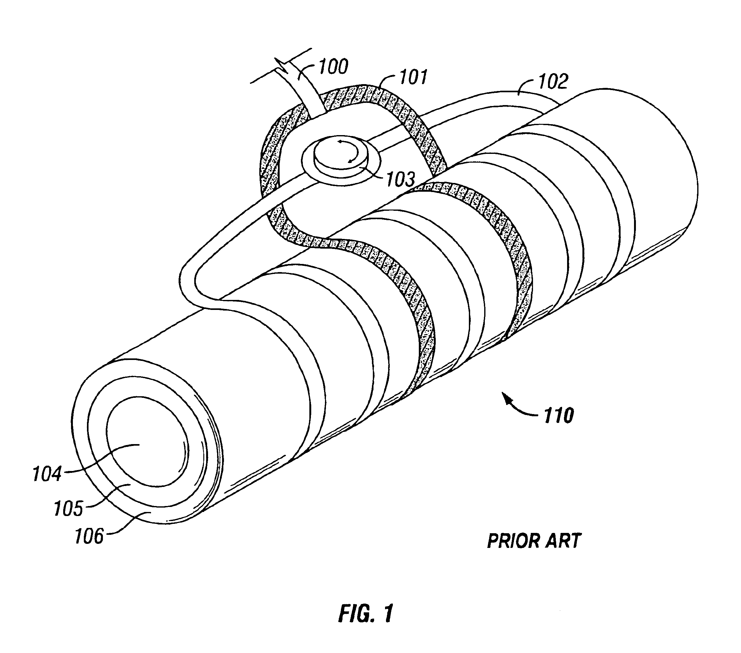 Apparatus for RF diathermy treatment