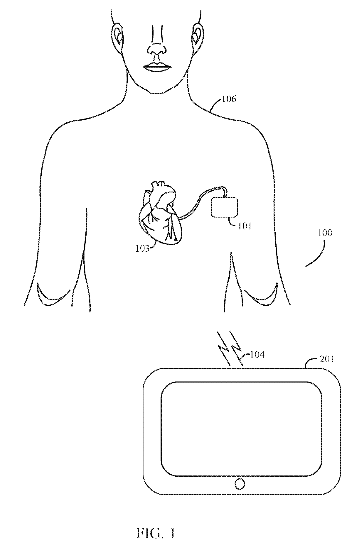 Managing dynamic connection intervals for implantable and external devices