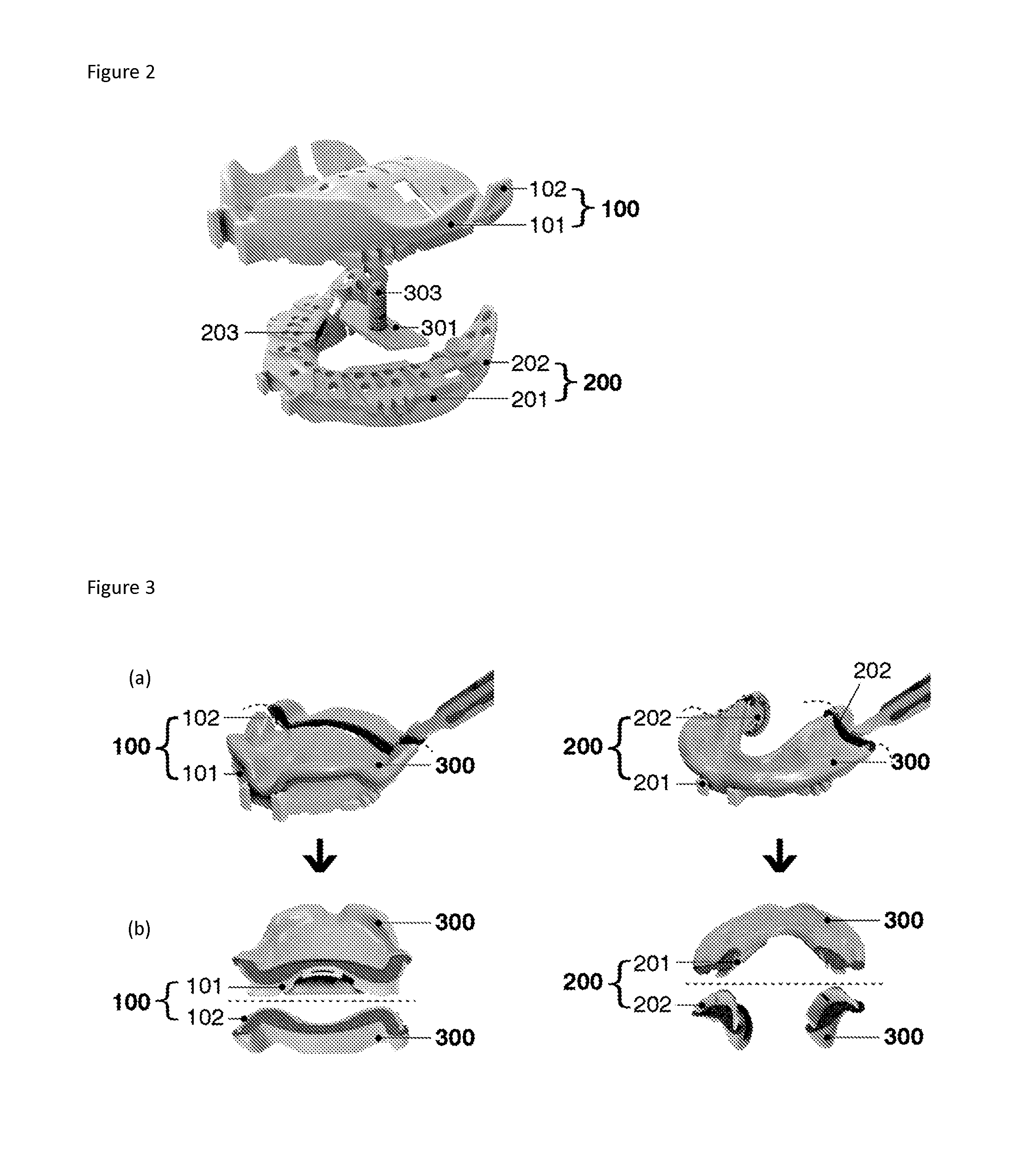 Method and apparatus for preparing removable dental prosthesis