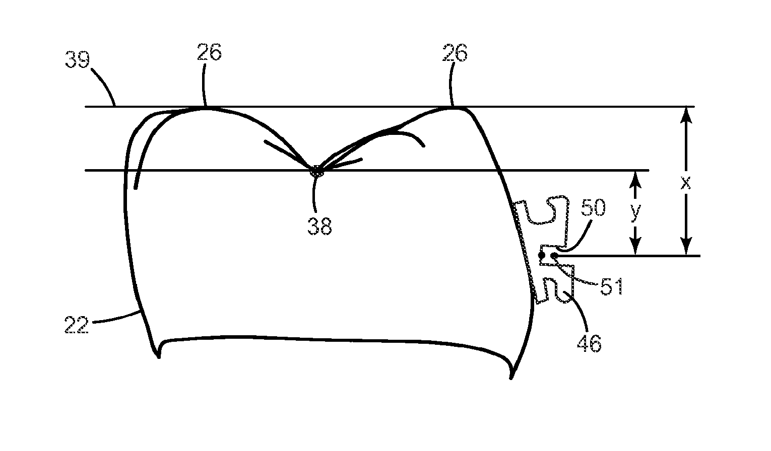 Methods and systems for determining the positions of orthodontic appliances