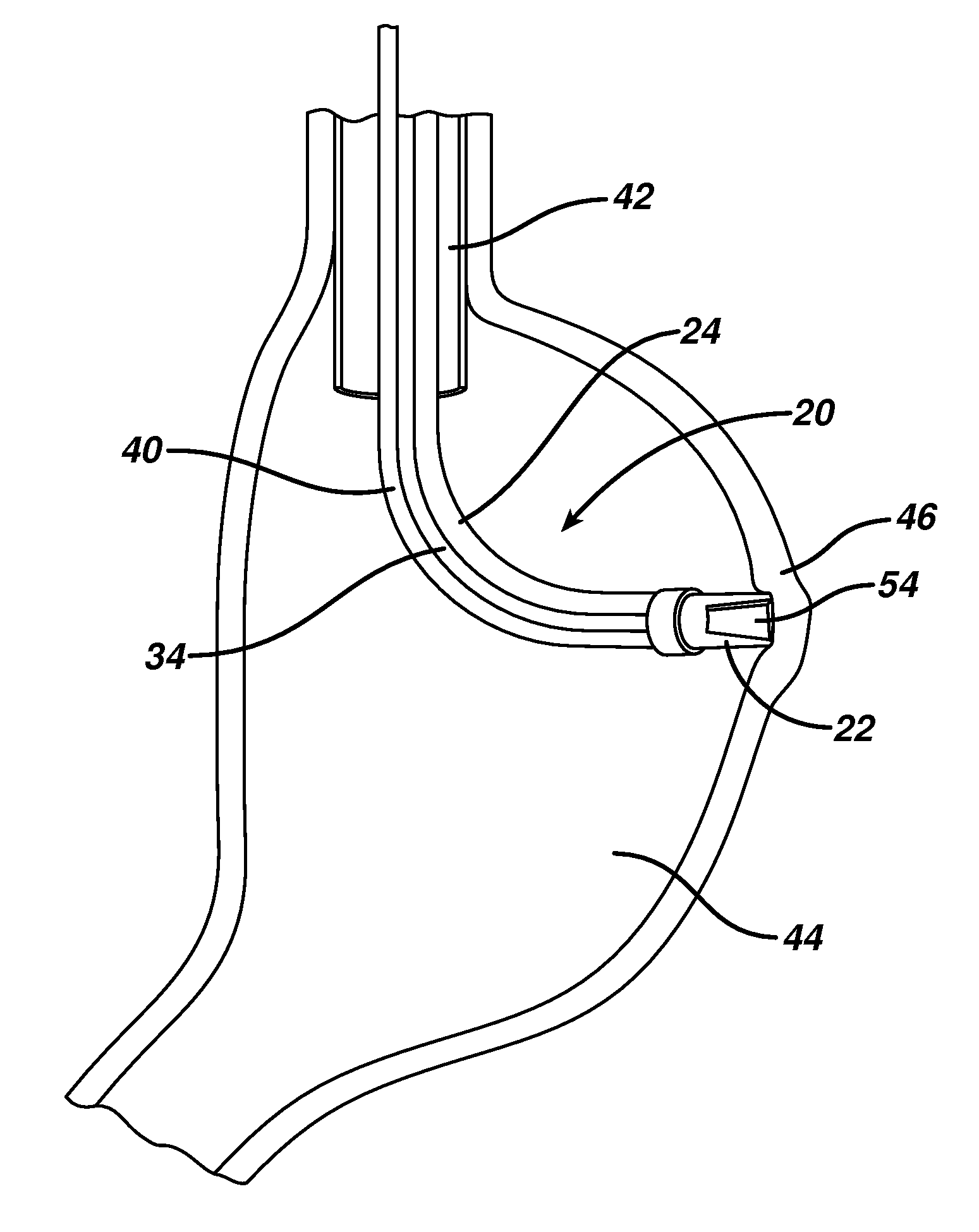 Device for plicating and fastening gastric tissue