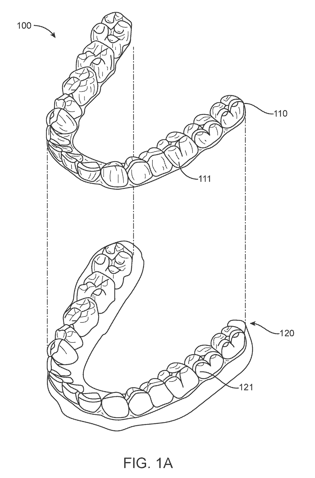 Devices, systems, and methods for dental arch expansion