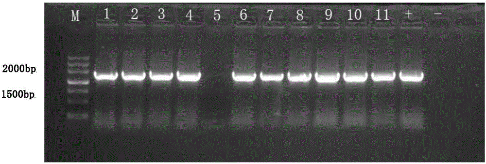 AaADH1 gene promoter and application and preparation method thereof