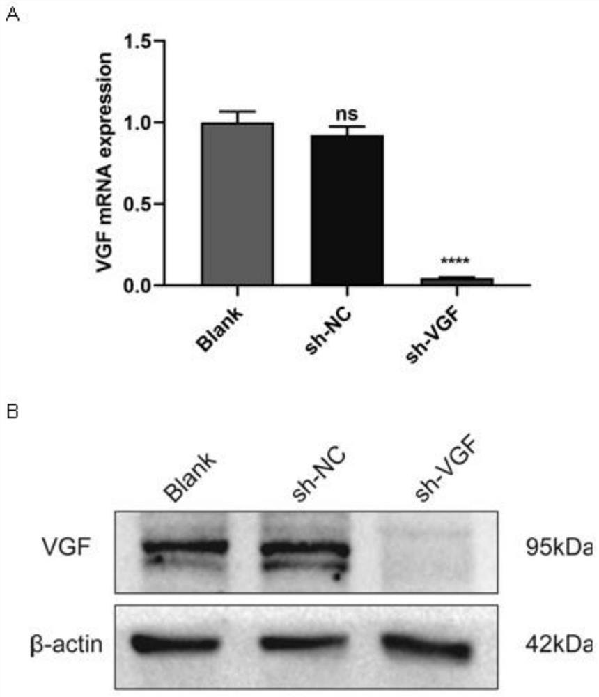 Application of VGF gene in treatment of metastatic prostate cancer