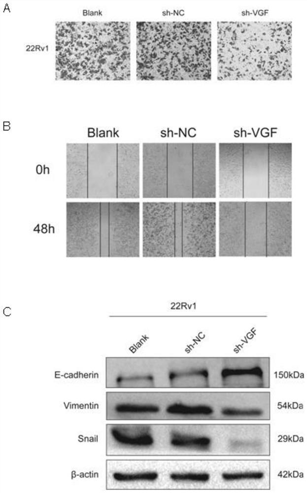 Application of VGF gene in treatment of metastatic prostate cancer