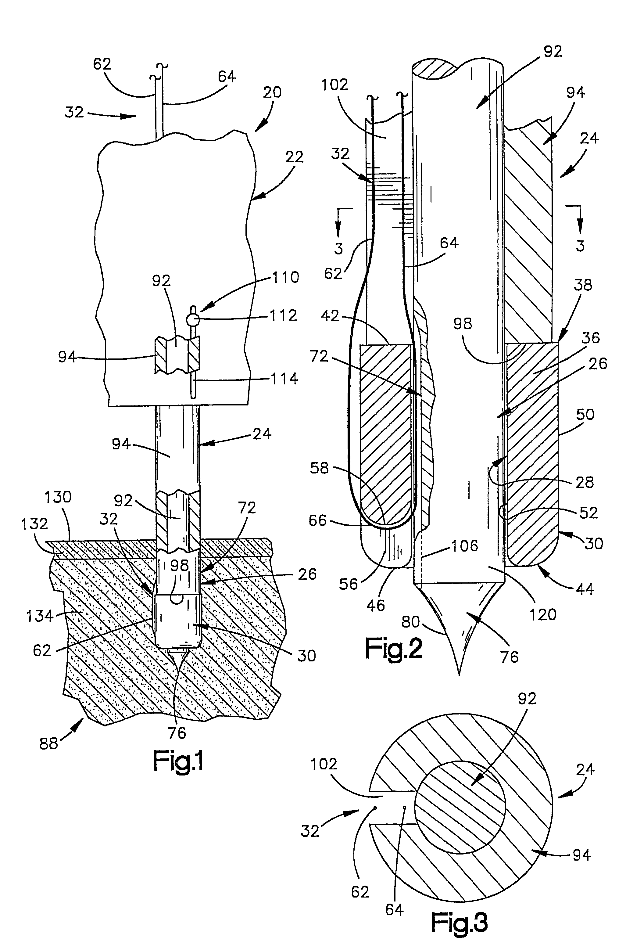 Apparatus and method for use in positioning an anchor
