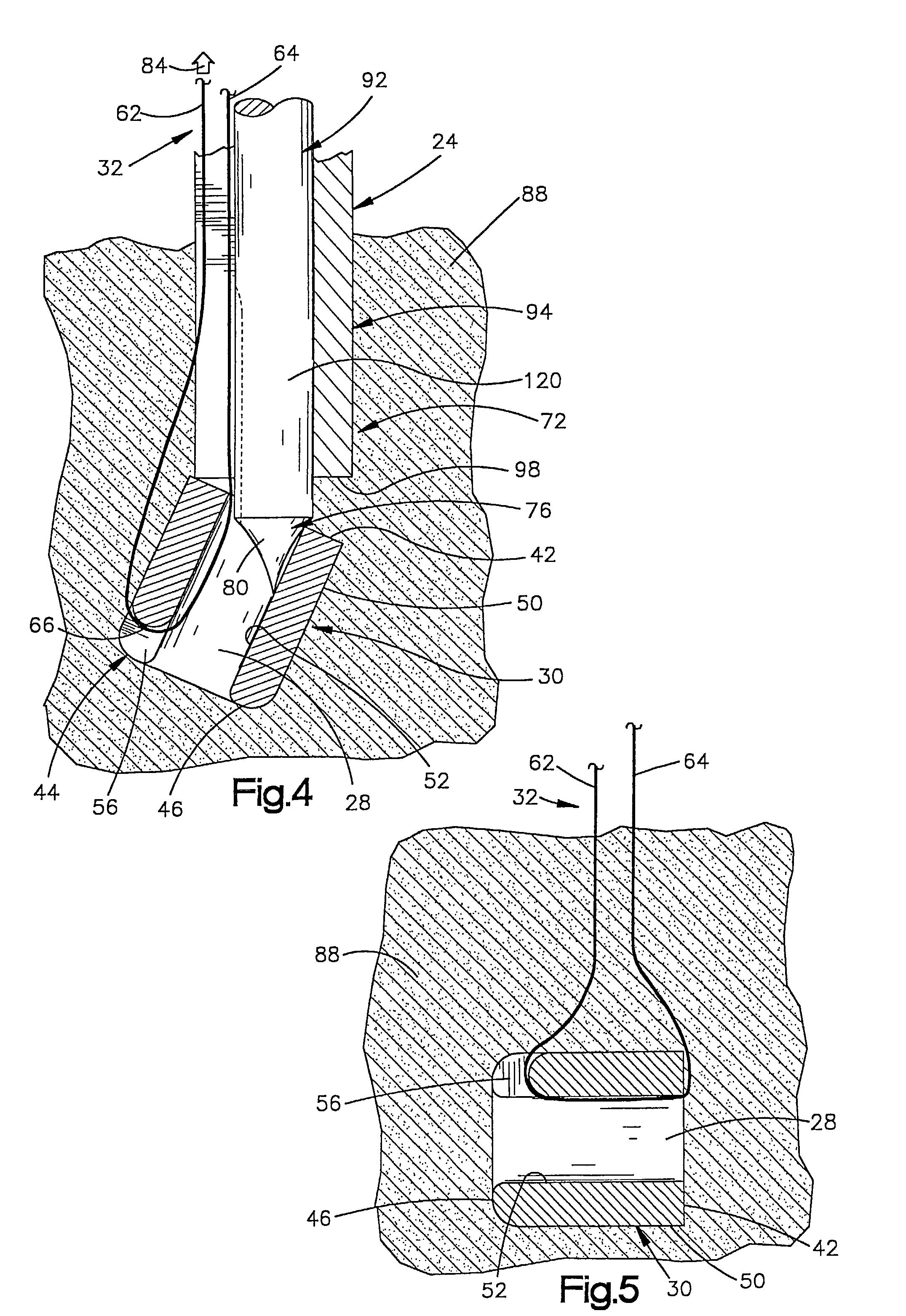 Apparatus and method for use in positioning an anchor