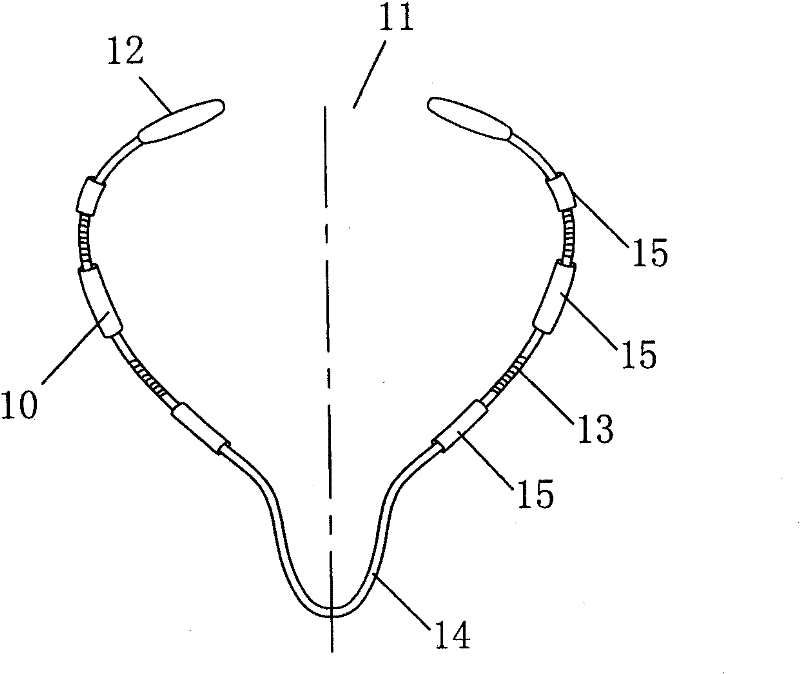 Safe open intrauterine device