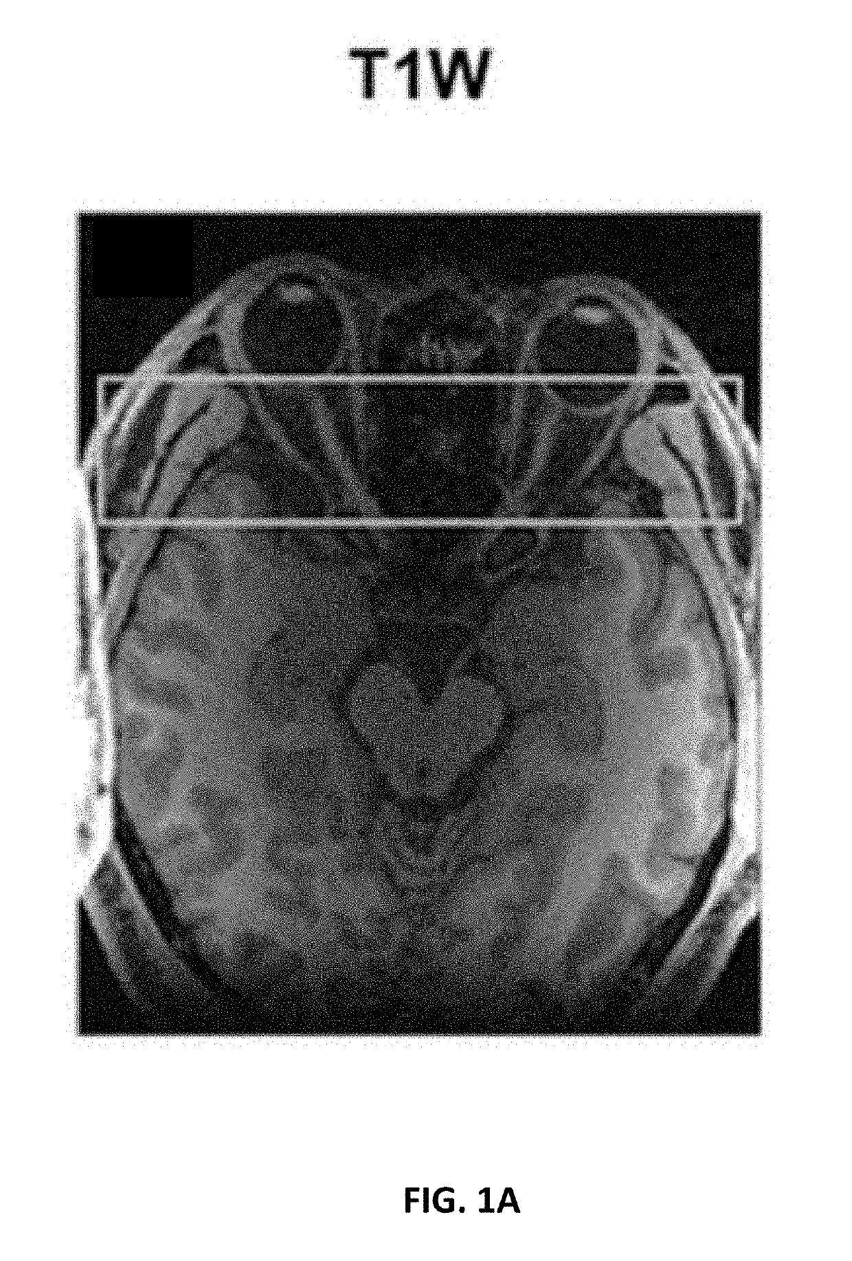 Imaging nerve function and pathologies