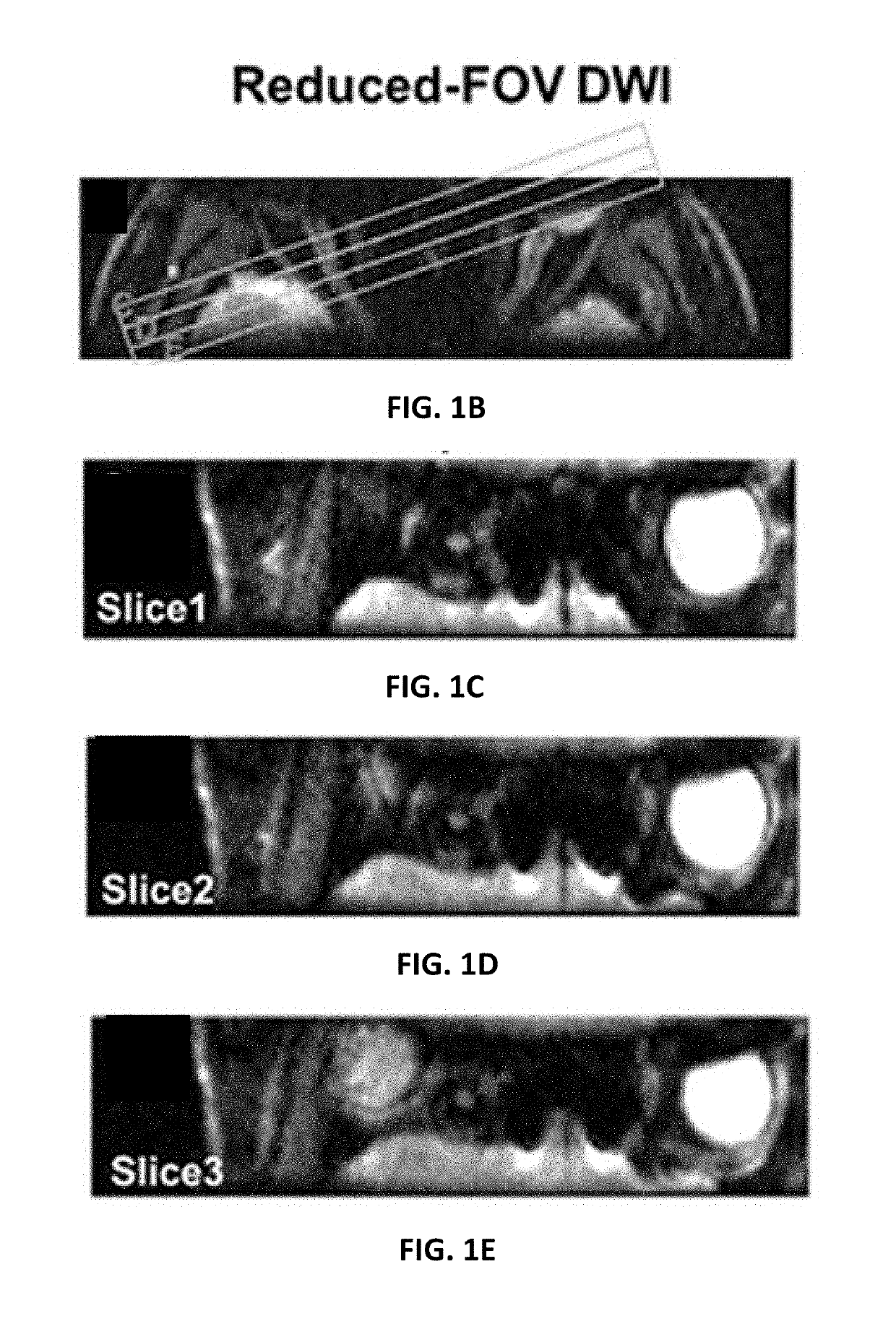 Imaging nerve function and pathologies