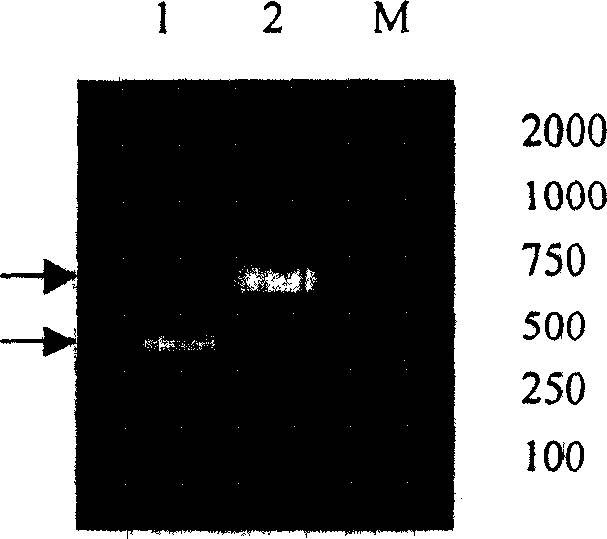 Recombinant Toxoplasma fusion protein antigen and preparation process and use thereof