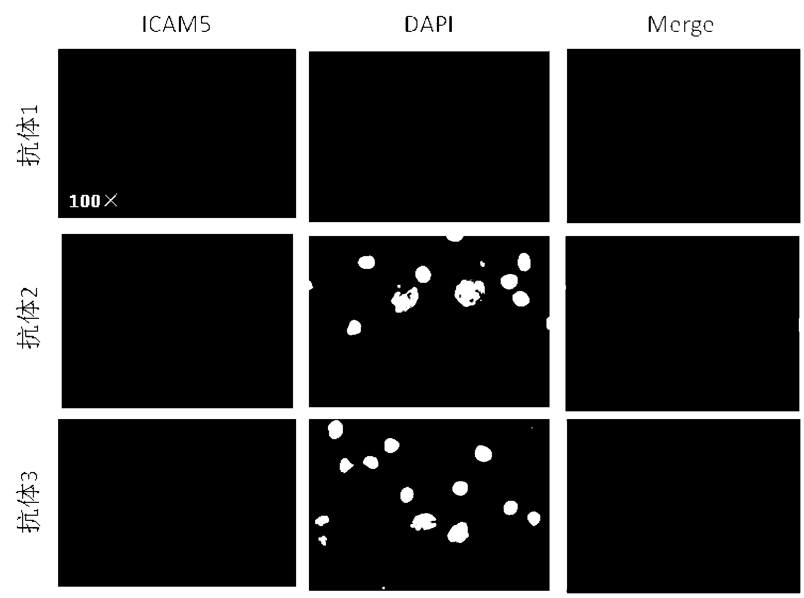 Cell adhesion molecule 5 monoclonal antibody, preparation method and applications thereof