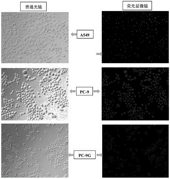 Method for adjusting sensibility of lung adenocarcinoma cells to EGFR-TKIs by mediating progesterone by mPR alpha