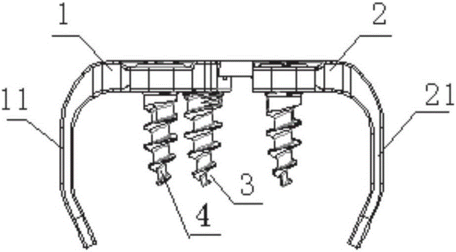 Sternum fixer