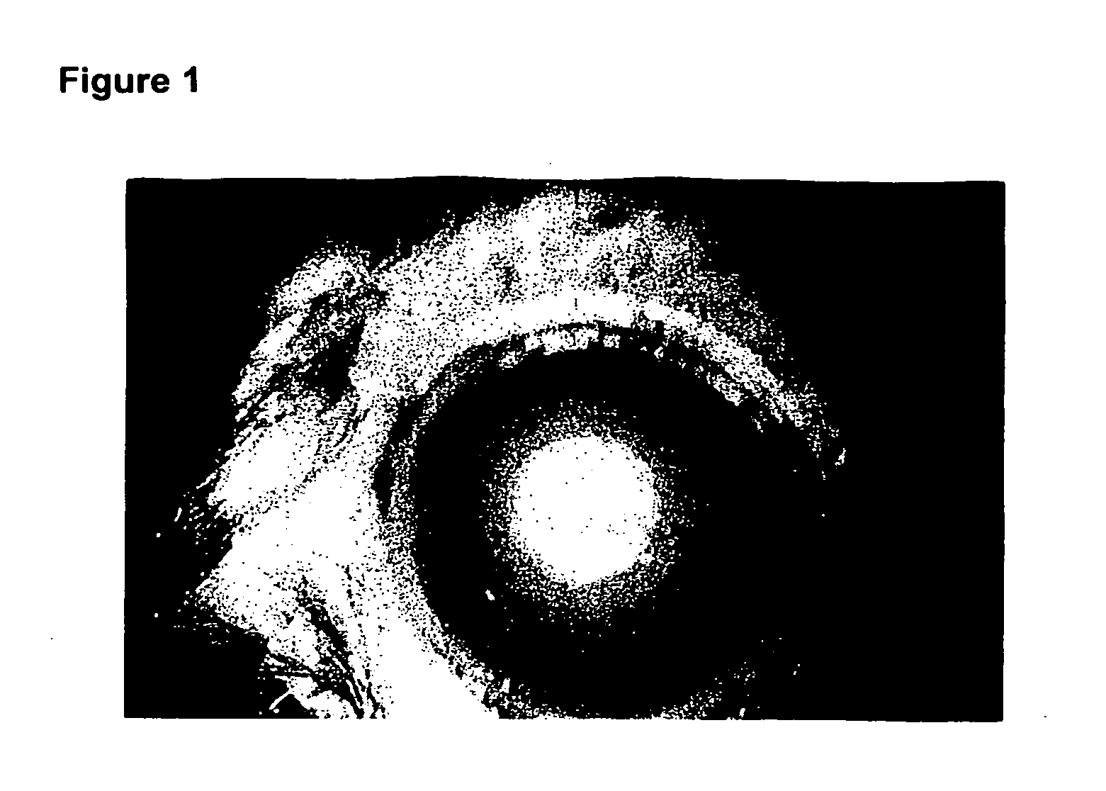 Tetracycline derivatives for the treatment of ocular pathologies