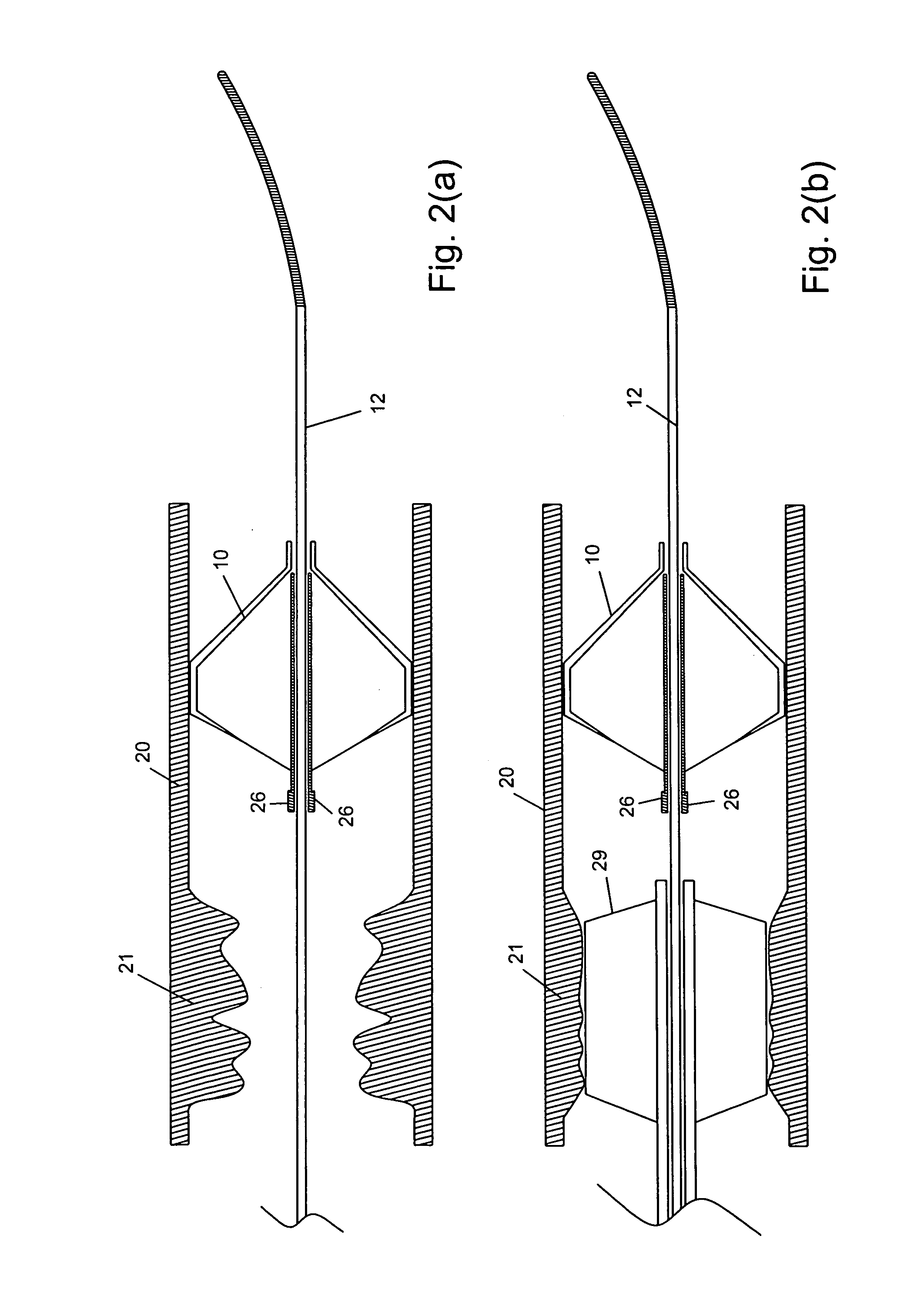 Embolic protection system