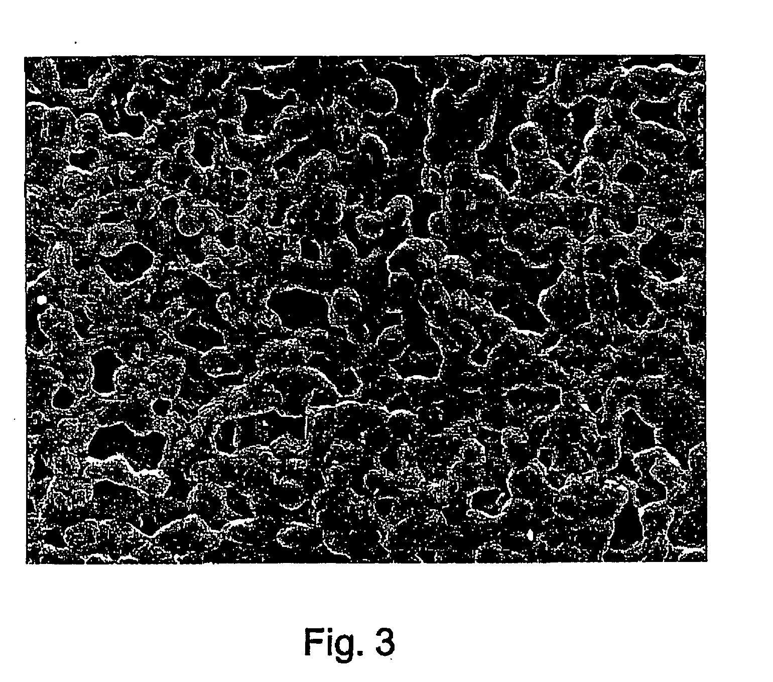 Biodegradable implant and method for manufacturing one