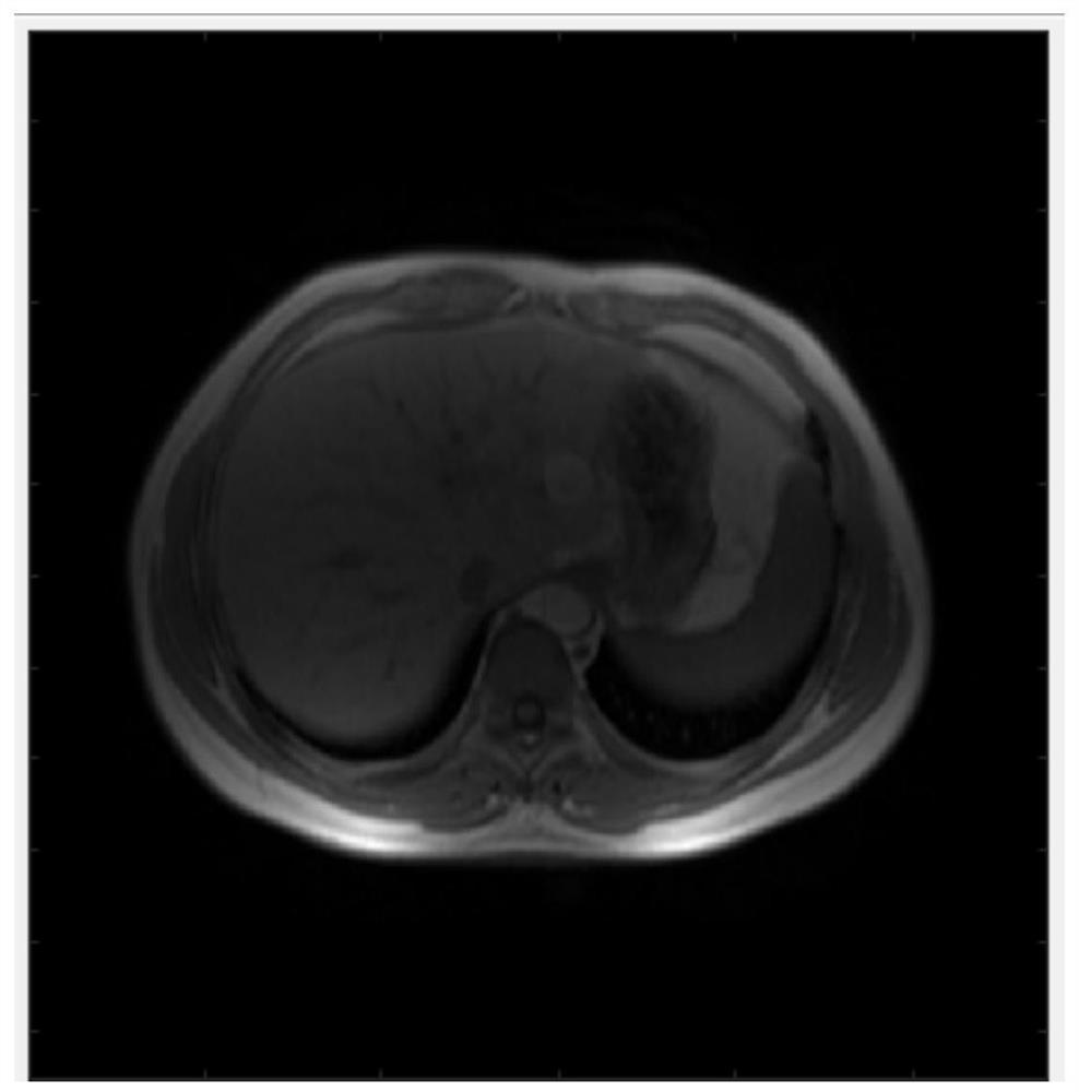 Phased array coil magnetic resonance image non-uniformity correction method based on projection estimation