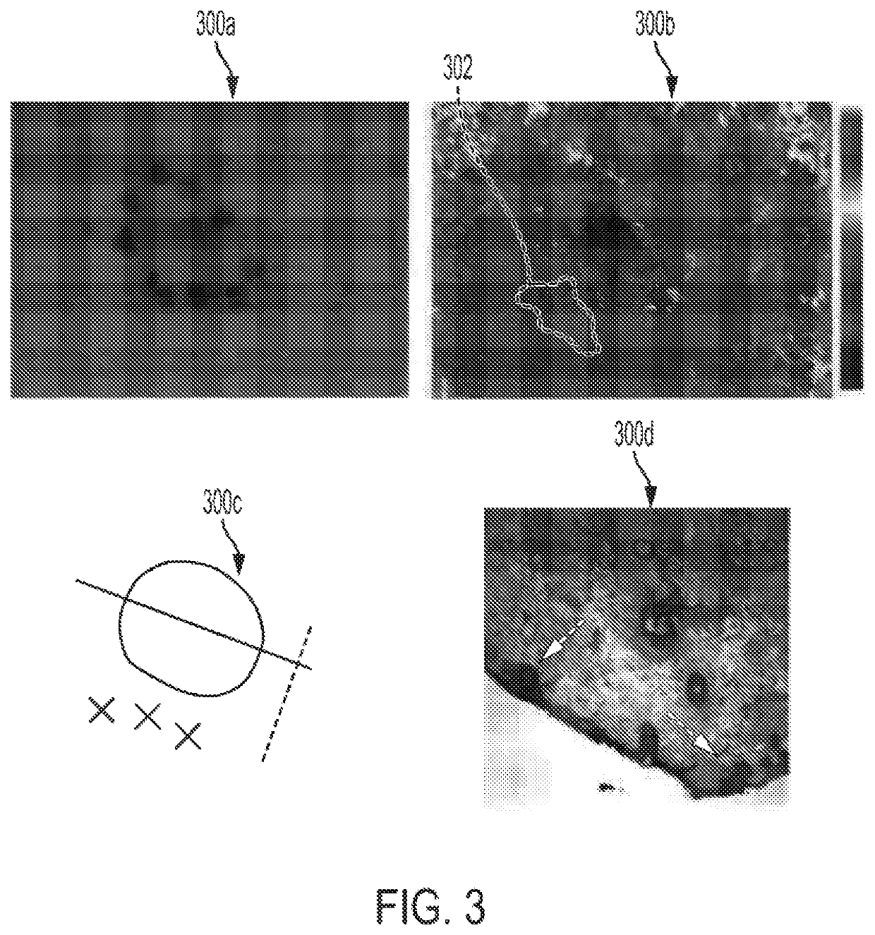 Spectrally encoded optical polarization imaging for detecting skin cancer margins