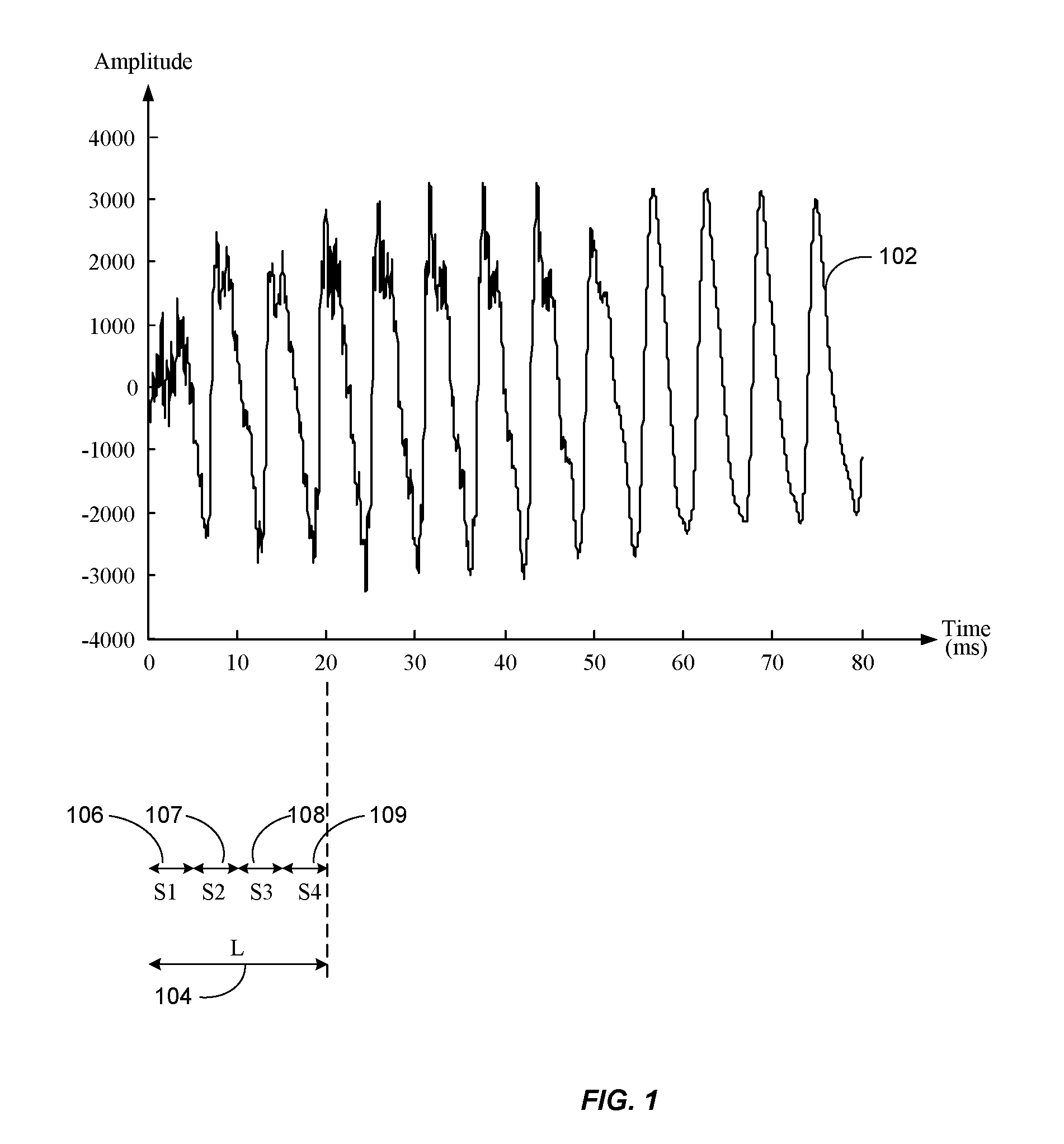 Dual-transform coding of audio signals