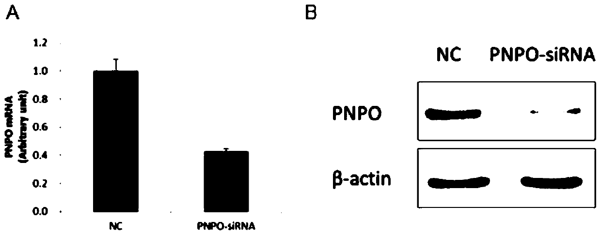 Lowering Pyridoxine Phosphate Oxidase in Ovarian Cancer