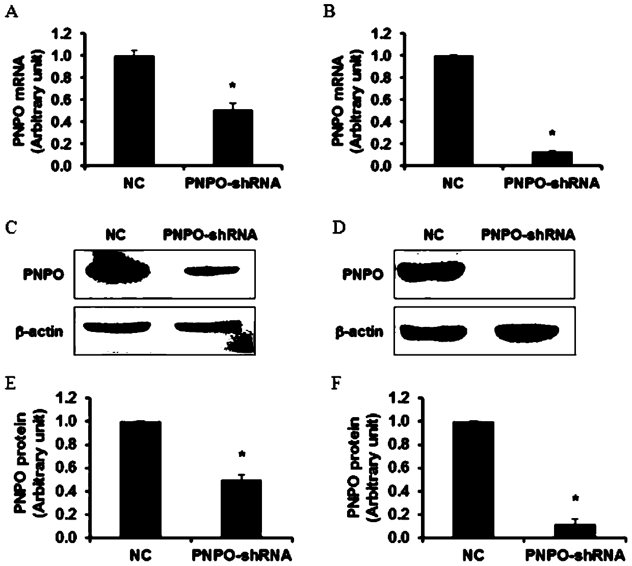 Lowering Pyridoxine Phosphate Oxidase in Ovarian Cancer