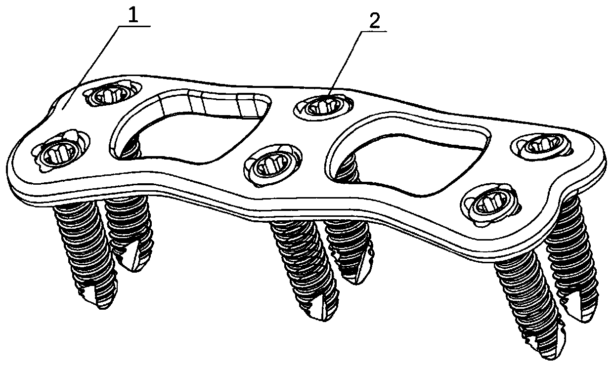 Novel anterior cervical spine fixing plate