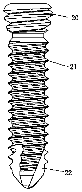 Novel anterior cervical spine fixing plate