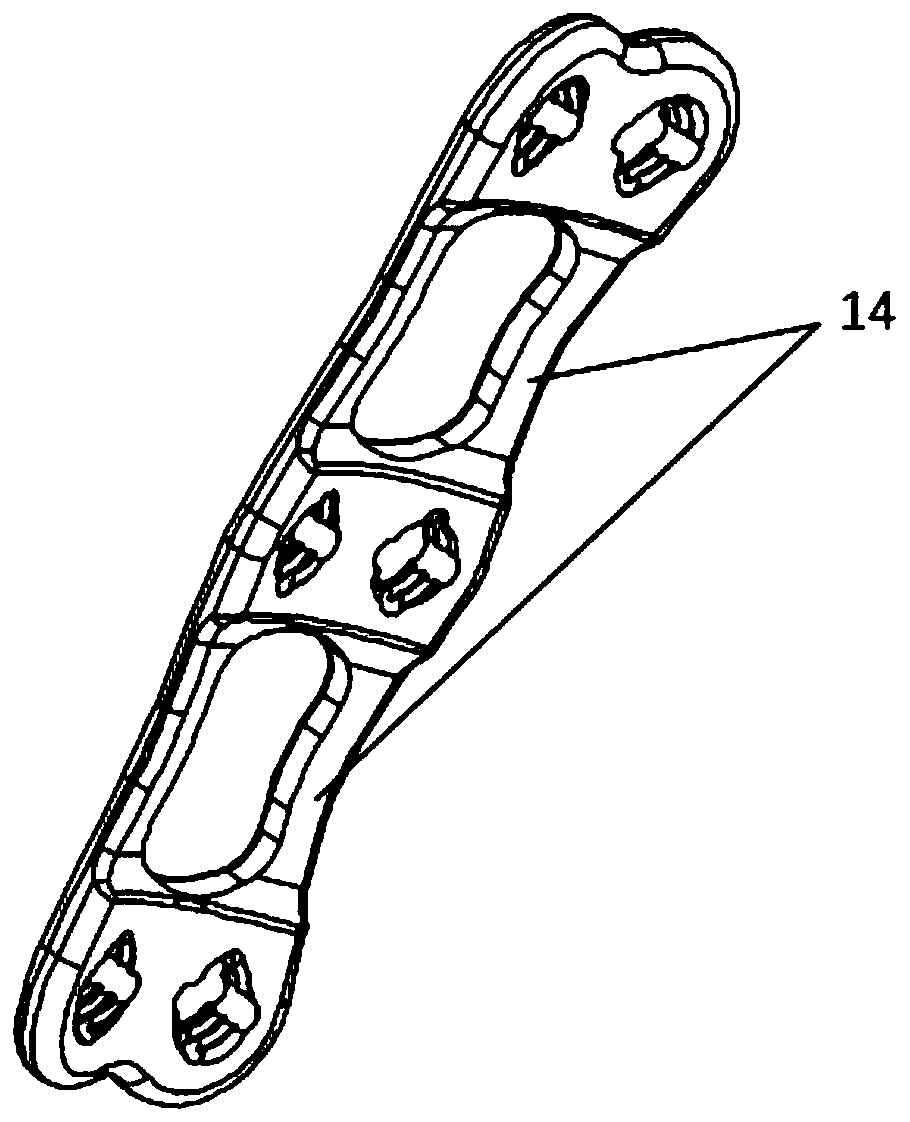 Novel anterior cervical spine fixing plate