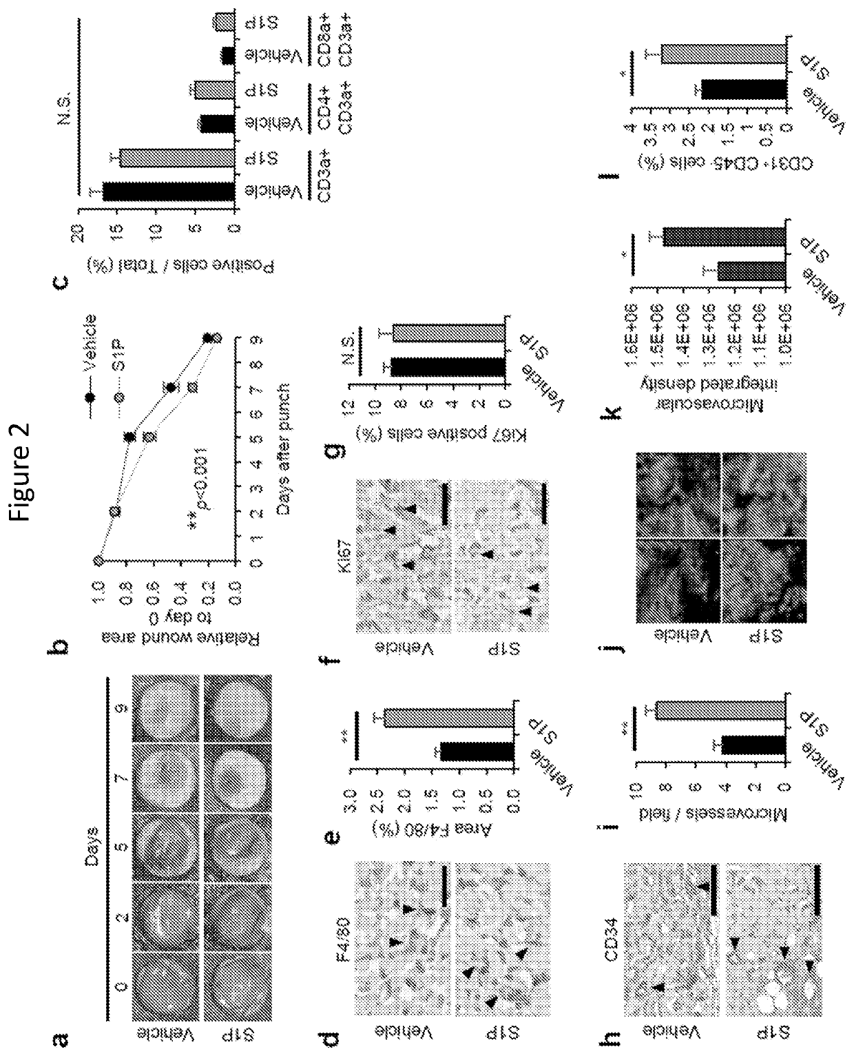 Compositions and methods for keloidless healing