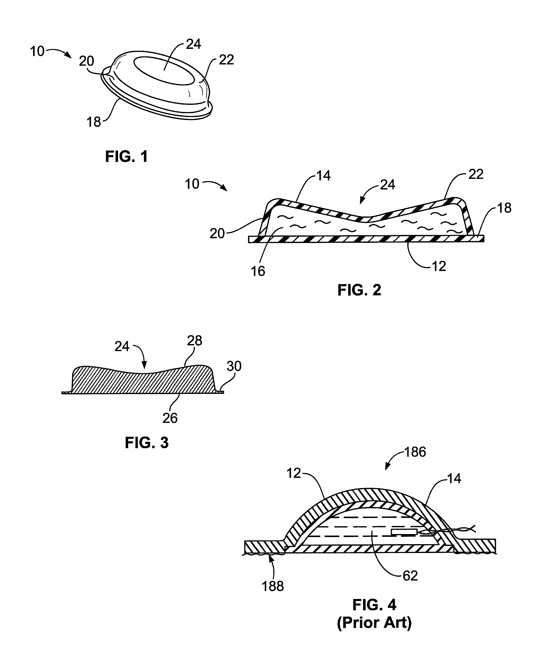 Sensor, sensor pad and sensor array for detecting infrasonic acoustic signals