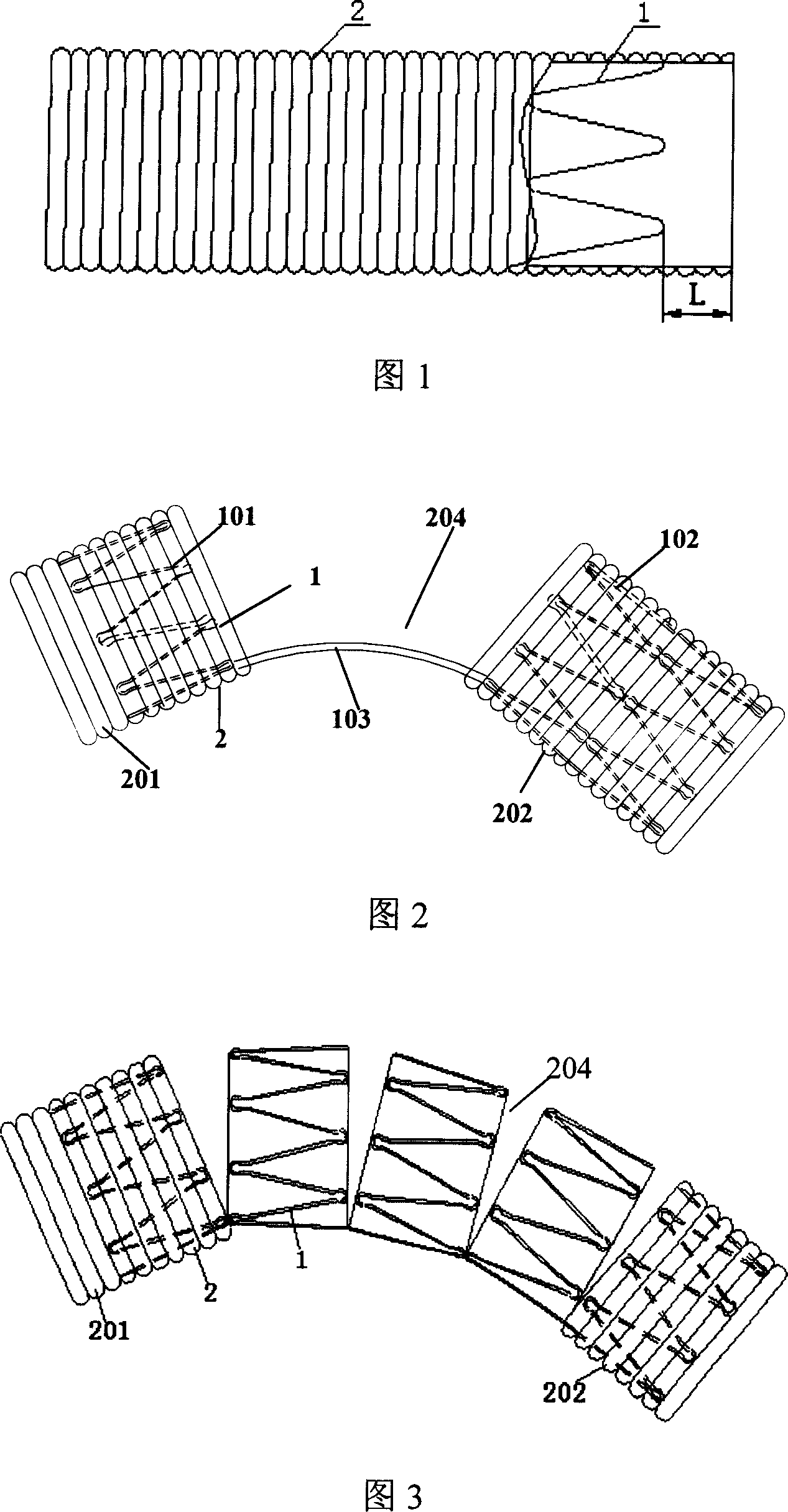 Stent prosthesis used for surgical operation, and delivery device therefor