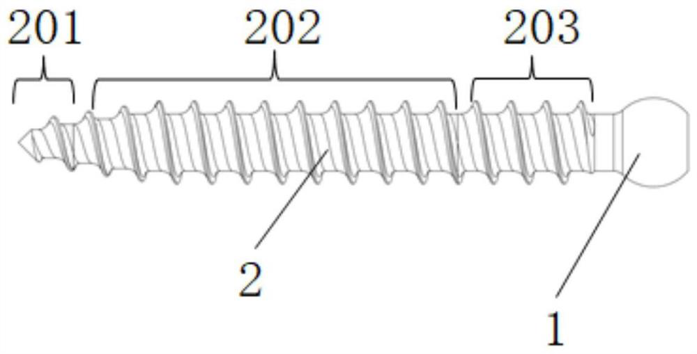 Medical bone nail for orthopedics department and preparation method thereof