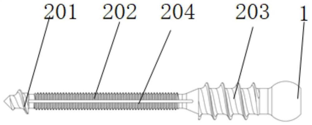 Medical bone nail for orthopedics department and preparation method thereof