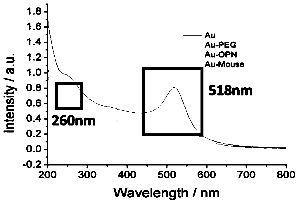 Nanoprobe for CT imaging of Kawasaki disease coronary artery inflammation, and preparation method and application thereof