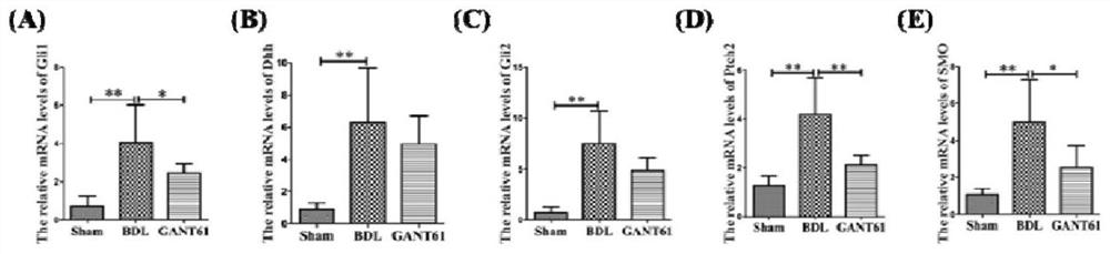 Application of Gli1 inhibitor to preparation of medicines for treating cholestatic liver fibrosis and liver cirrhosis