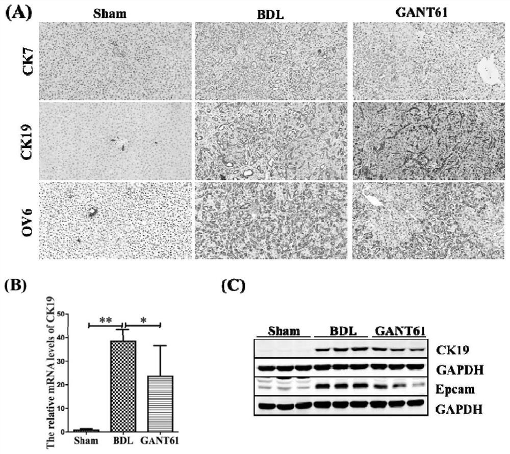 Application of Gli1 inhibitor to preparation of medicines for treating cholestatic liver fibrosis and liver cirrhosis