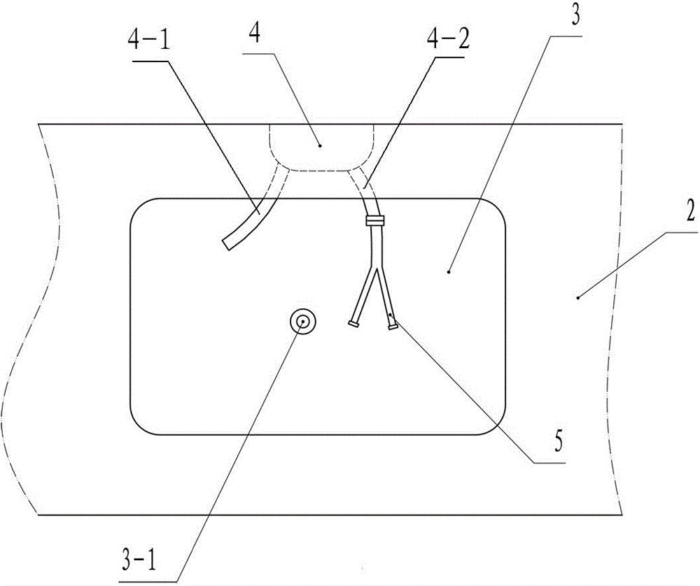 Endoscope cleaning and disinfecting method