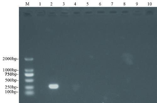 Identification method for existence of fungus in ganoderma lucidum tissue and assessment method for necessity of fungus for formation of ganoderma lucidum