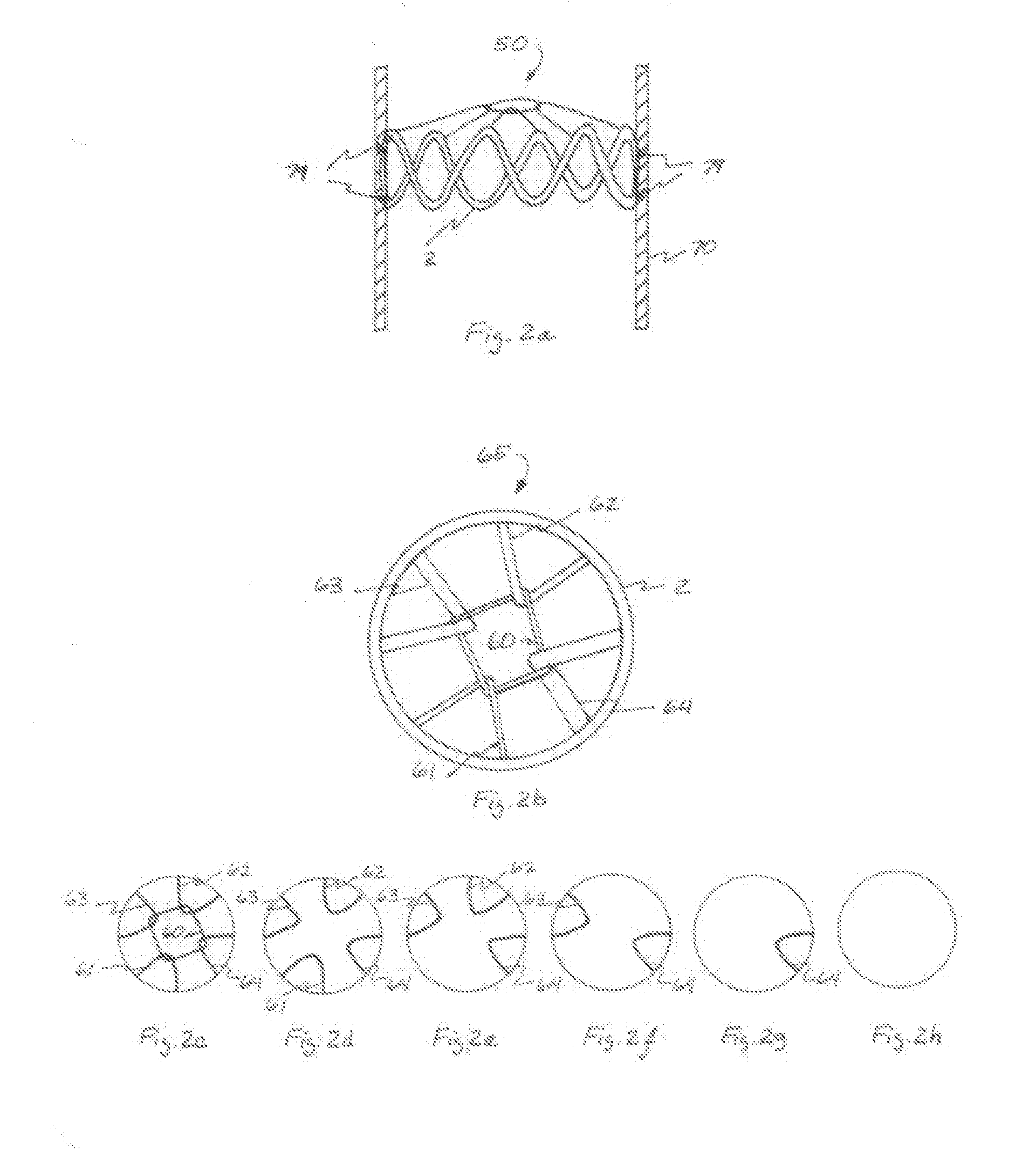 Absorbable Vascular Filter