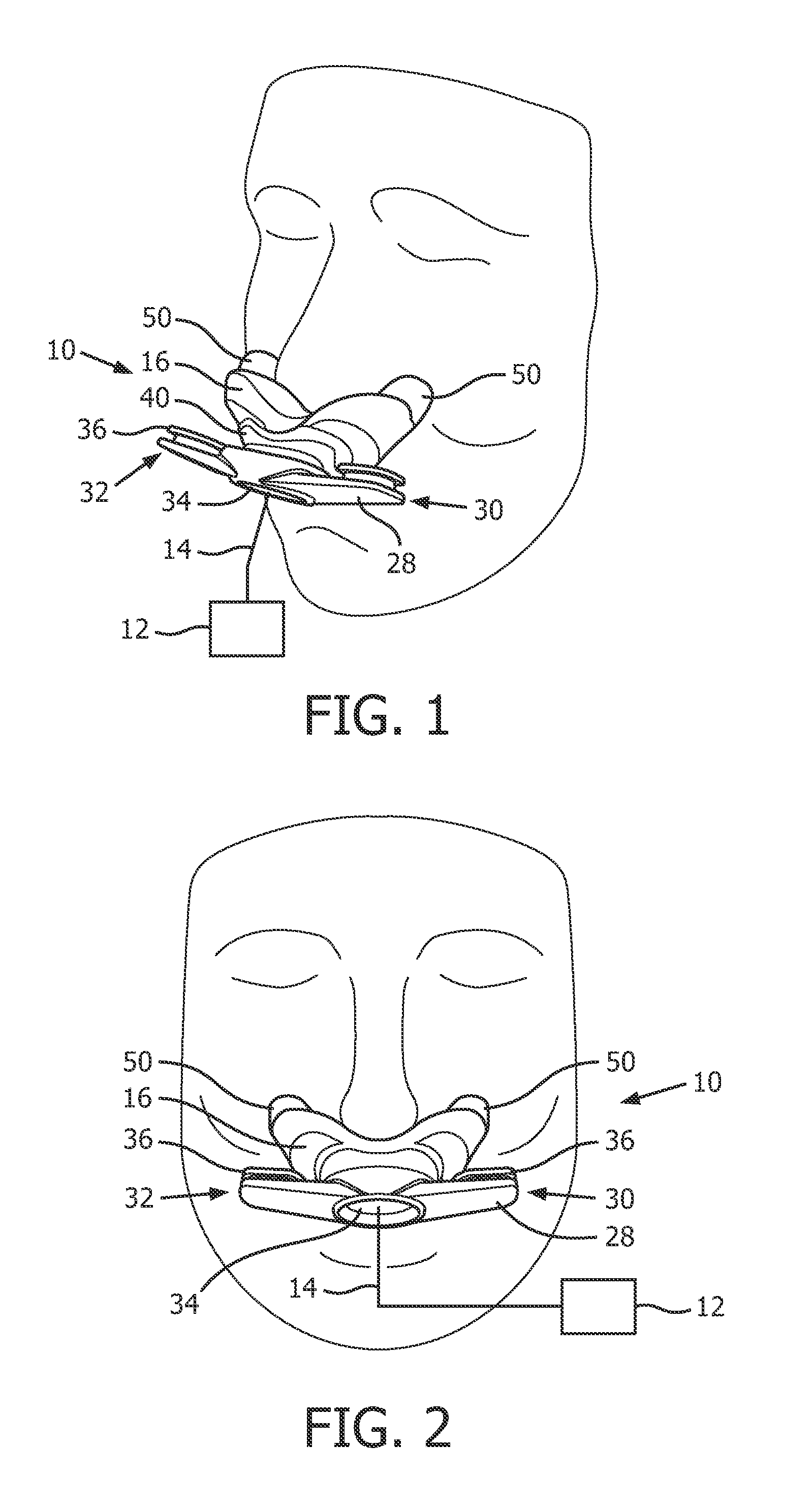 Stabilized mask